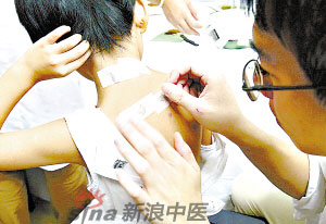 灸法的種類  你知道多少？