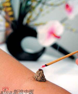 節(jié)氣灸” 冬至，你灸了嗎？