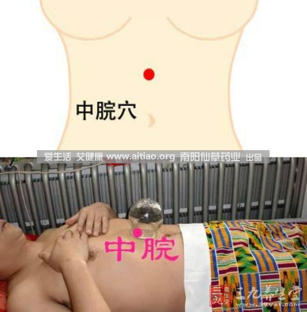 中脘穴位于腹部正中線，臍上4寸的位置上。每天艾灸10-15分鐘，能有效緩解胃部不適的癥狀，同時(shí)有助于祛濕。